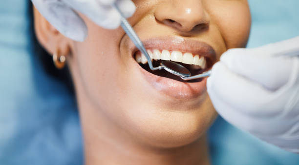 Best Emergency Dental Care for Abscessed Tooth in Ranchester, WY